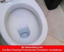 Urinesteen Pakket - Voor Het Verwijderen Van Urinesteen En Het Voorkomen Van Urinesteen - 1x Urinesteenoplosser - 2x Toiletreiniger -Schoonmaakartikelen Winkel 1200x971 4